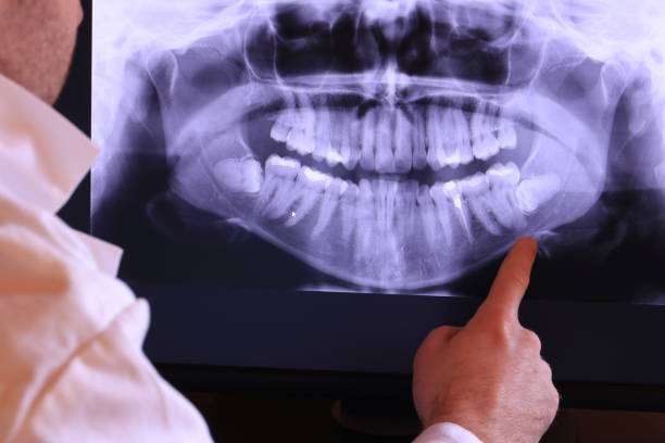 Best Emergency Gum Treatment in New Hackensack, NY