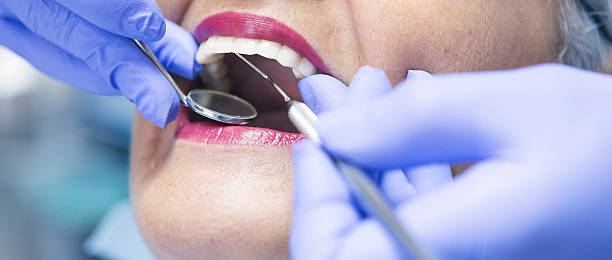 Best Emergency Wisdom Teeth Removal in New Hackensack, NY